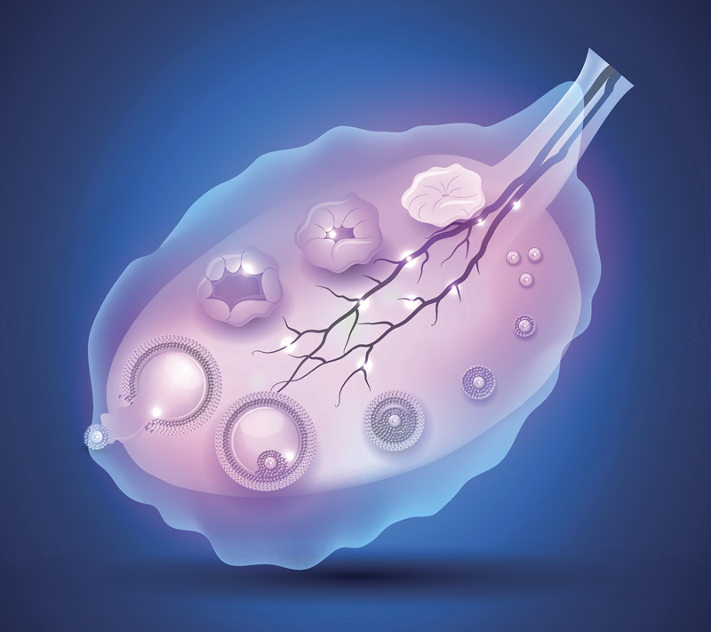 揭秘试管&ldquo;包成功&rdquo;套餐背后的对赌协议：签合同前必须看清的3个条款！